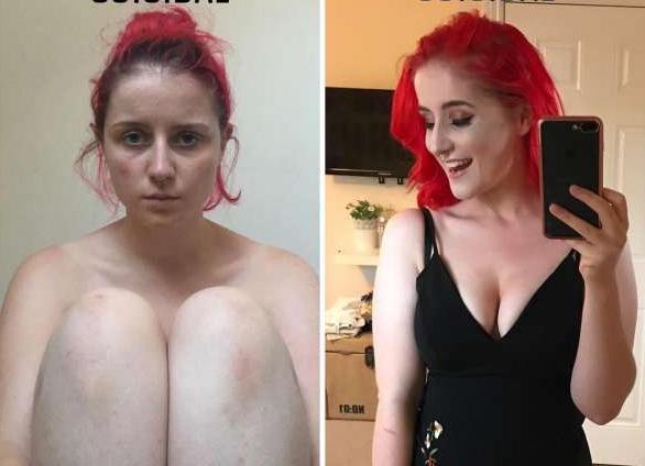 У депрессии нет лица: почему люди улыбаются, даже если им очень тяжело